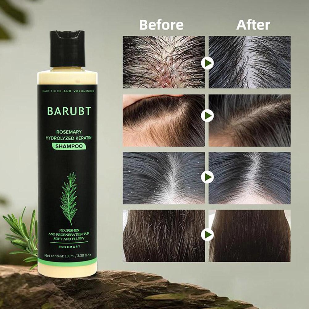 แชมพูโรสแมรี่ บำรุงเส้นผม กระต - Rosemary Hair Oil บทวิจารณ์และราคา