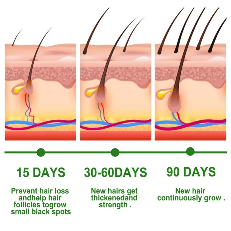 Hair Growth Serum Fast Growing - Hair Care Essence Oil บทวิจารณ์และราคา